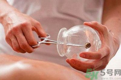 ​拔罐后可以洗澡吗?拔罐后多久才可以洗澡