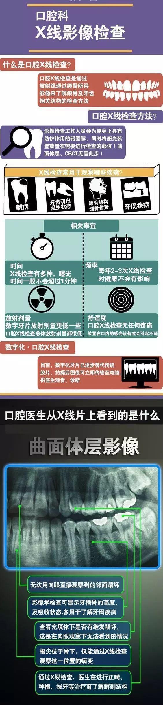 为什么看牙要先拍片呢？