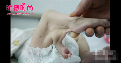 长了三条腿的人图片 长有3条腿的女人