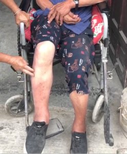 律师网购处方药被隔空诊断半身不遂案续:法院认定互联网医院违规开方