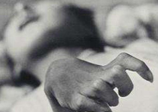 日本水俣病起因(非常典型的一例环境污染事件)(1)_