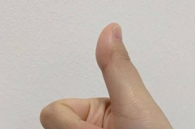 ​大拇指为什么又叫大拇哥