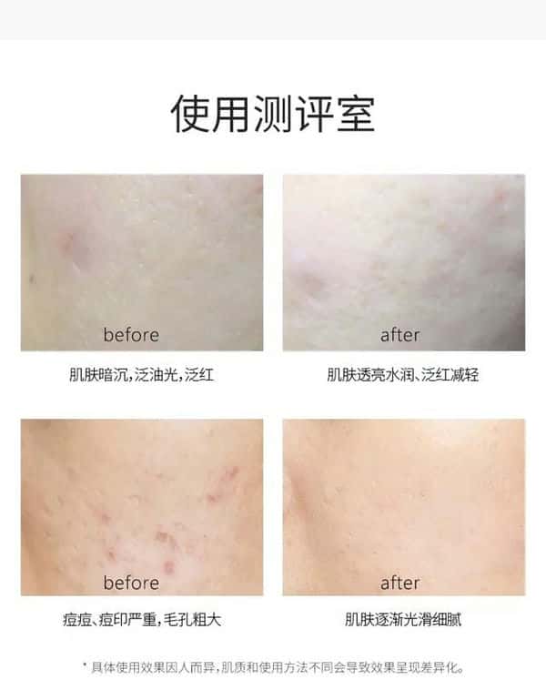 vt老虎面膜怎么样(vt老虎面膜)