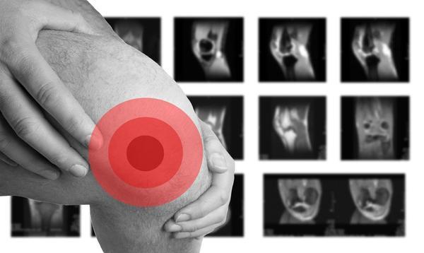 膝盖疼痛可能有三种病（膝盖经常出现疼痛现象）(2)