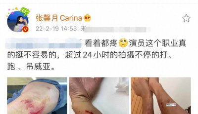 ​林峯拍戏意外受伤！胳膊多处伤口红肿严重，表面皮肤受损露出血肉