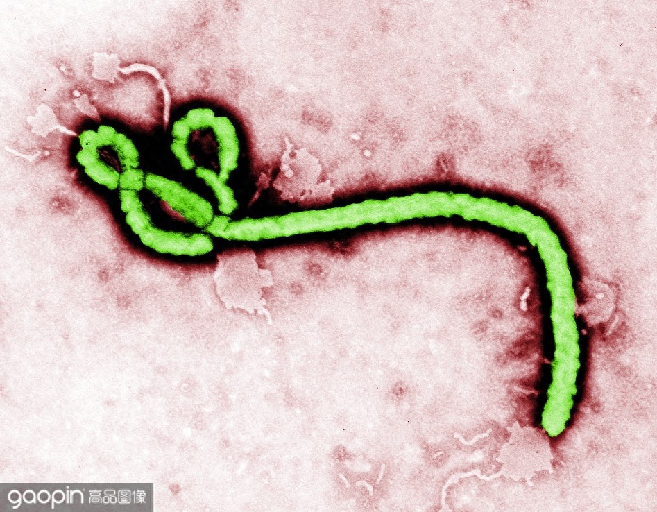 形似“如意”，却杀人于无形，探索你不知道的病毒秘密