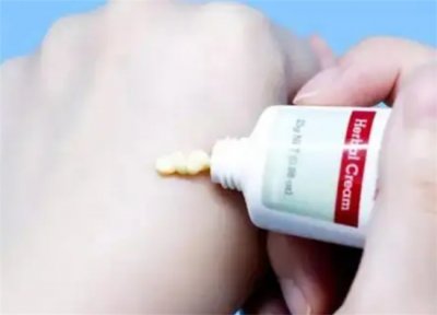 ​鱼痣的去除方法有哪些